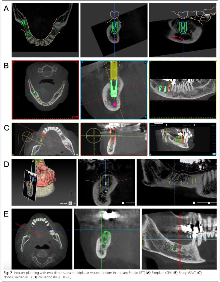 Dental technician viewing axial sagittal and coronal CBCT views